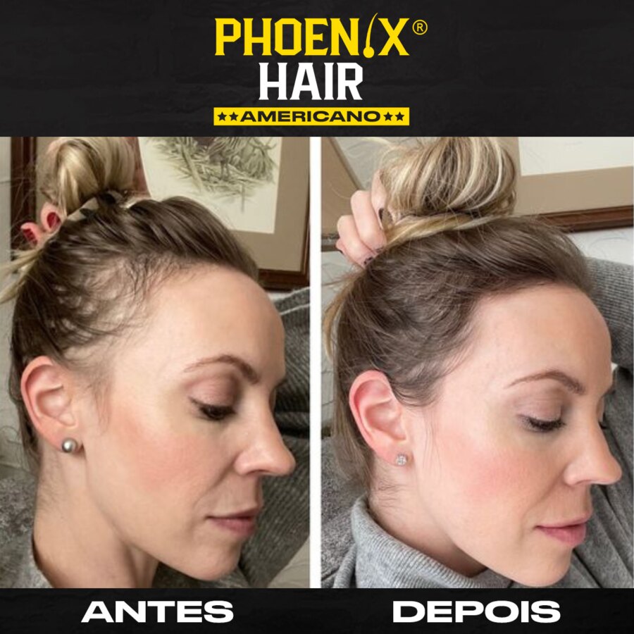 Antes e depois de cliente Phoenix Hair