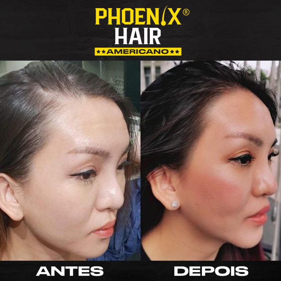 Antes e depois de cliente Phoenix Hair
