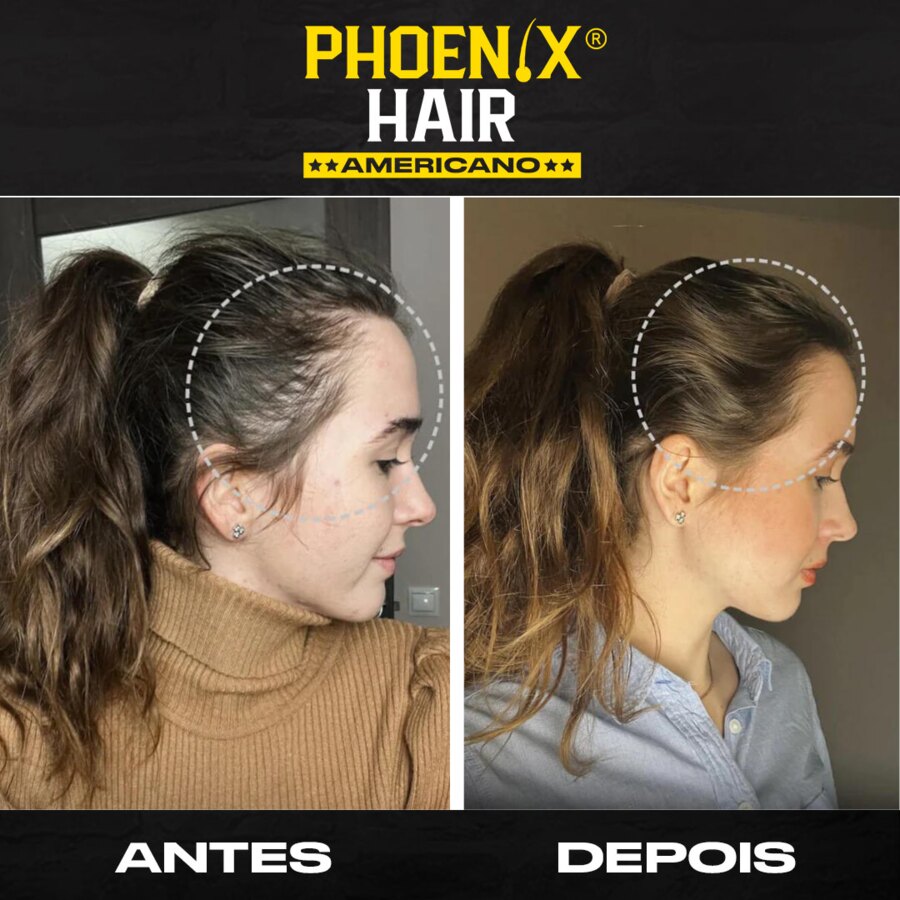 Antes e depois de cliente Phoenix Hair