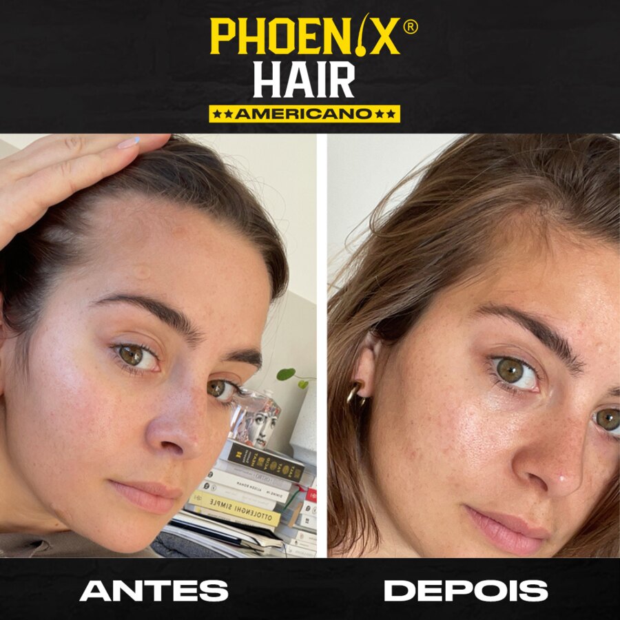 Antes e depois de cliente Phoenix Hair